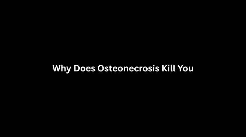 Why Does Osteonecrosis Kill You? Causes, Risks, and Treatment