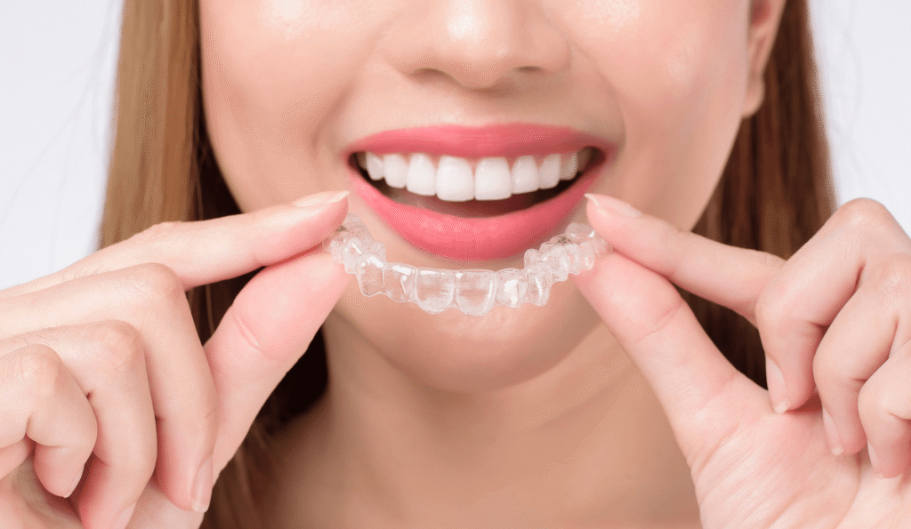 Top Benefits of Choosing Invisalign for Adults and Teens